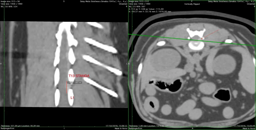 Ct2